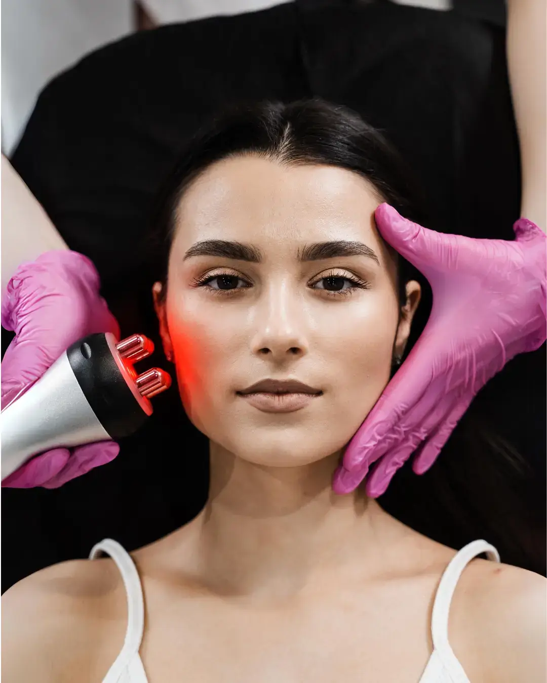 Радиочестотен лифтинг