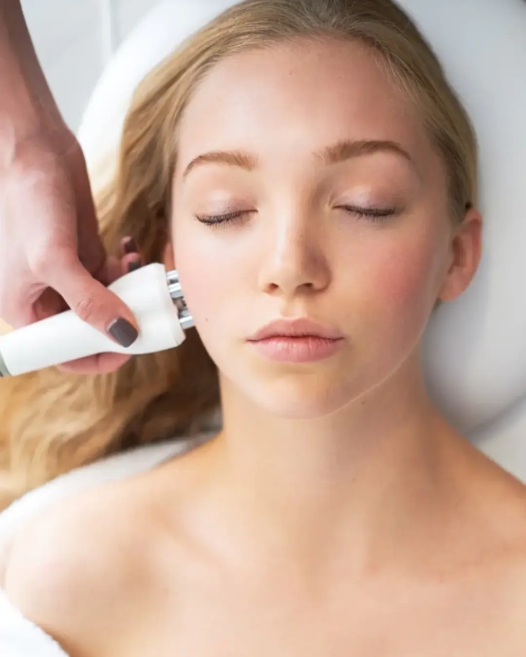 Ползи от радиочестотния лифтинг