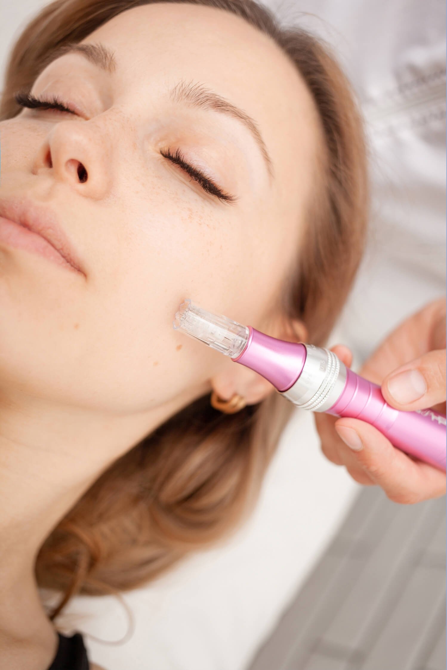 Как протича процедурата по микронидлинг