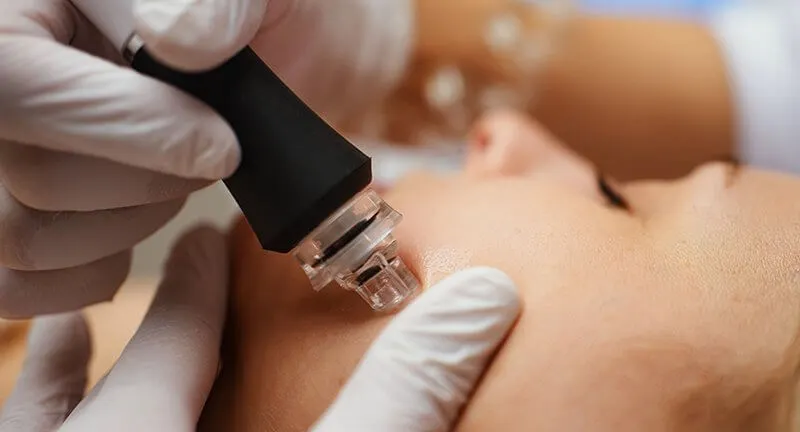 Водно дермабразио - добро решение ако цените красотата си