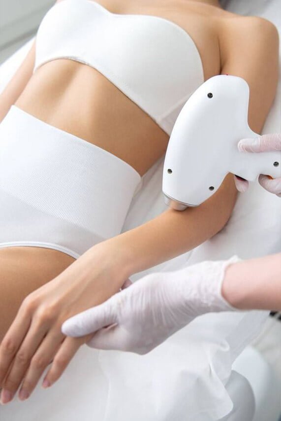 Какво е лазерна епилация